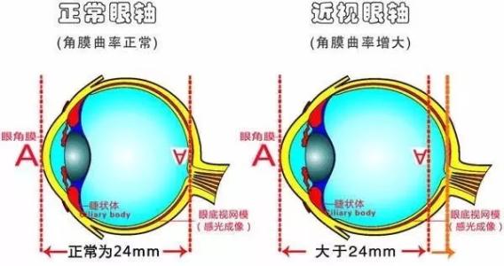 u=577571890,1327545714&fm=27&gp=0.jpg